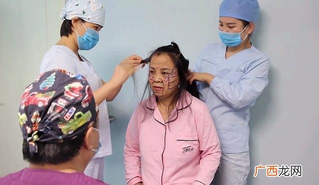 面部提升哪个效果好 现在做什么美容项目可以提升