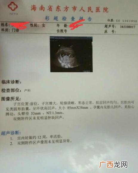 12周做nt医生说孩子小,小周医生说