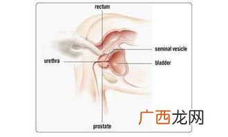 前列腺钙化是什么意思,前列腺炎钙化是什么意思？