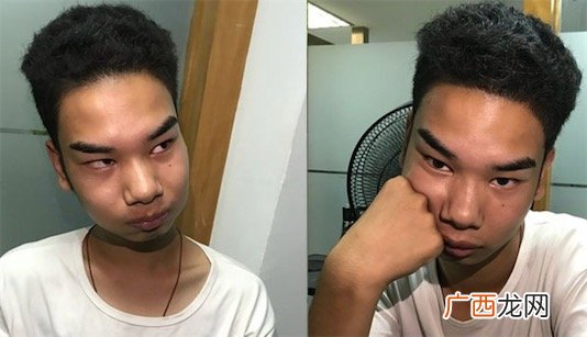 发际线男孩是什么意思什么梗 发际线男孩是谁