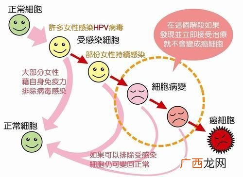 hpv是什么意思,什么是hpv疫苗?