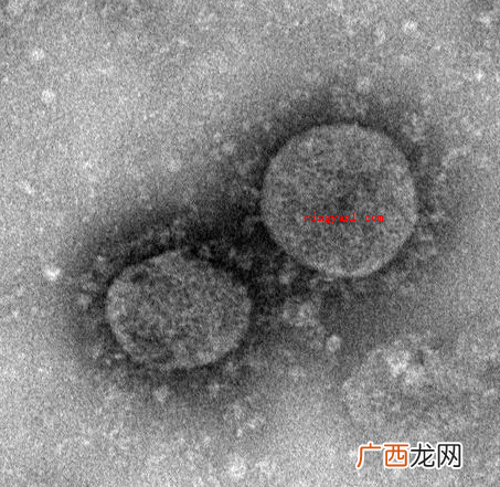 新冠病毒英文名是什么?