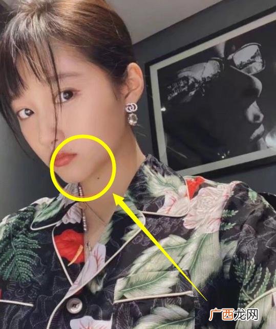 关晓彤喉咙中间的痣影响颜值吗 关晓彤喉咙正中间有颗痣