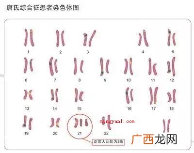 213什么意思