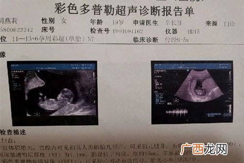 nt是什么意思,nt服务什么意思？