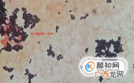 毛囊炎初期症状和图片
