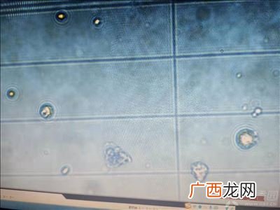 蓝台是什么,高尔夫术语发球台是什么意思？