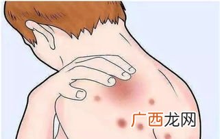 恶寒是什么意思,网络用语恶寒什么意思？
