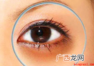 你会因为黑眼圈焦虑吗