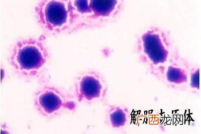 女性解脲支原体阳性是什么意思,女性uu解脲脲原体阳性什么意思？