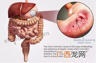 隐血试验阳性是什么意思,尿隐血阳性是什么病？