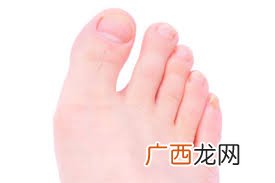 toe是什么意思,ktoe是什么单位？