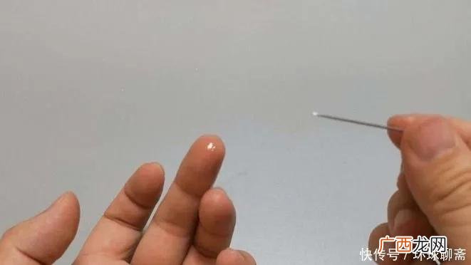 4个方法快速去除手上的刺 手里扎了个小刺挑不出来怎么办