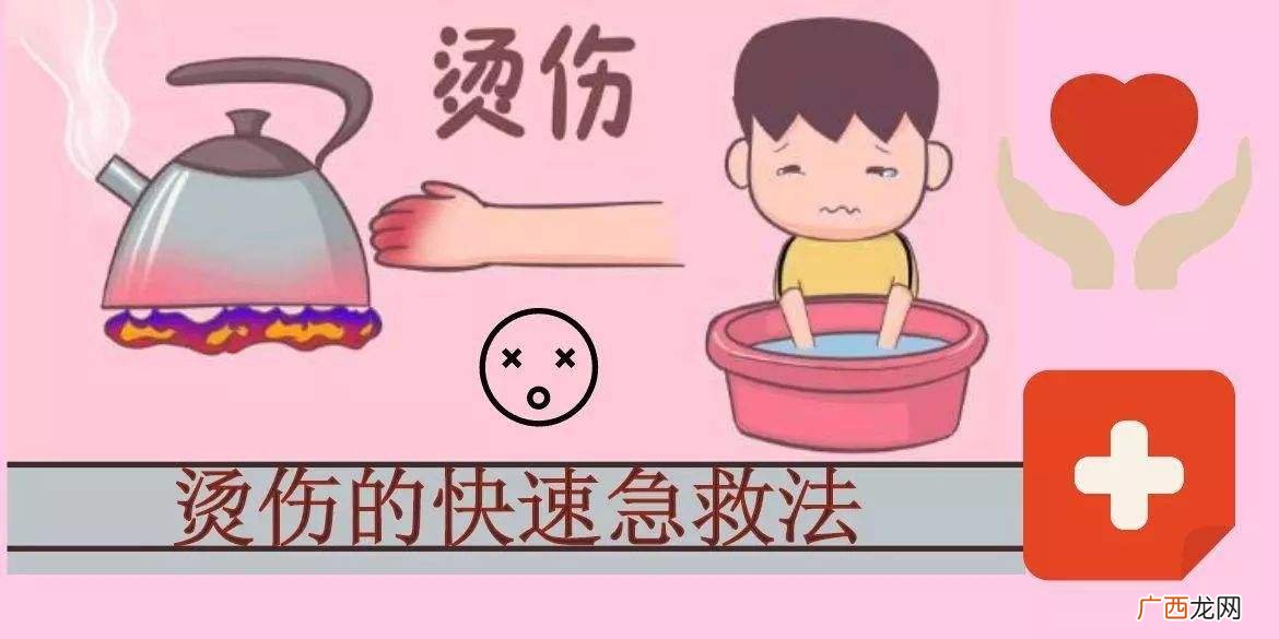 烫伤起的水泡几天能瘪下去 烫伤水泡一般几天会消