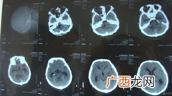 ct是什么意思,ct成像是什么意思？