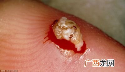 沙蚤是什么,什么除沙蚤的？