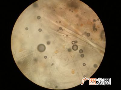 酒精能杀墙上的霉菌吗,家里墙上长毛有什么好办法吗？