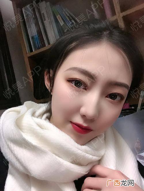 蛇精脸是什么意思,两头尖脸属于什么脸型?