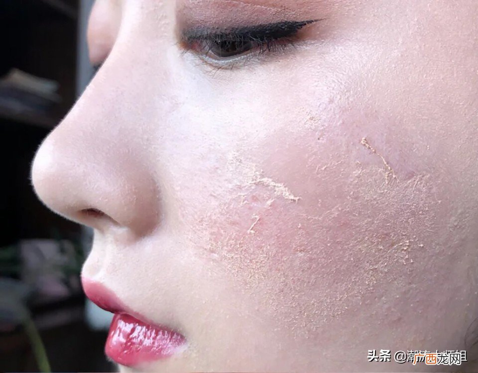化妆后总是搓泥怎么办才好 搓泥是什么原因引起的
