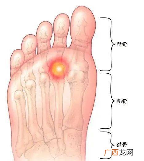 跖怎么读跖的读法,足字旁加个皮读什么？