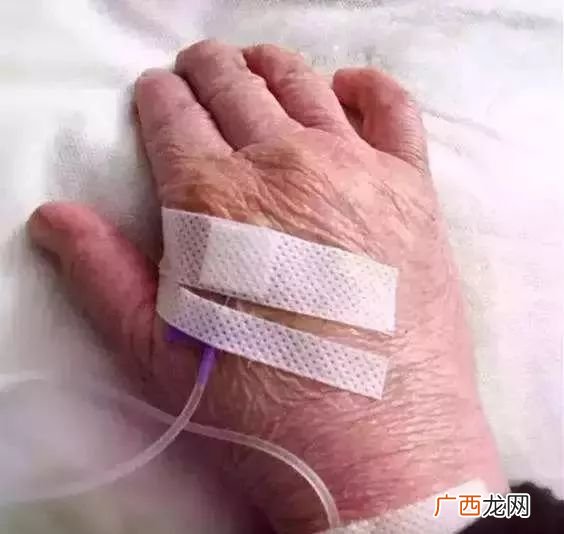 什么叫穿刺,魔兽争霸的穿刺攻击是什么意思？