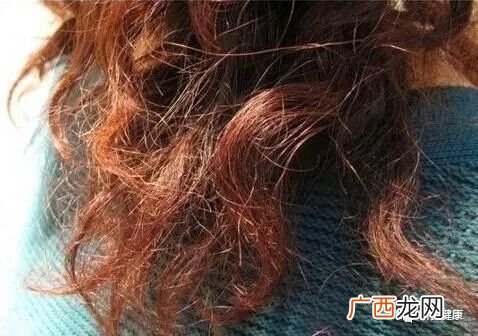 头发干枯是怎么回事,头发干枯像稻草怎么办？