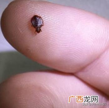 跳蚤怎么去除,怎么去除跳蚤？
