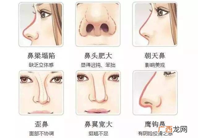 4种最有财气的鼻子面相特征 什么鼻子最好最旺财