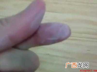 ab滴胶弄到手上怎么办