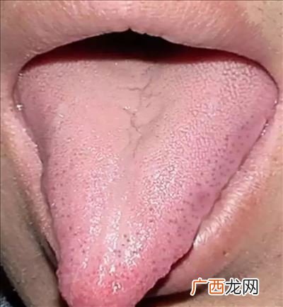 舌头长的人有什么特点,什么动物的舌头能达到一米？