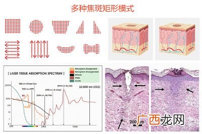 点阵激光是什么工作原理呢,谁了解易科美纳米点阵嫩肤美容仪美容原理是怎样的?皮肤会变薄么？