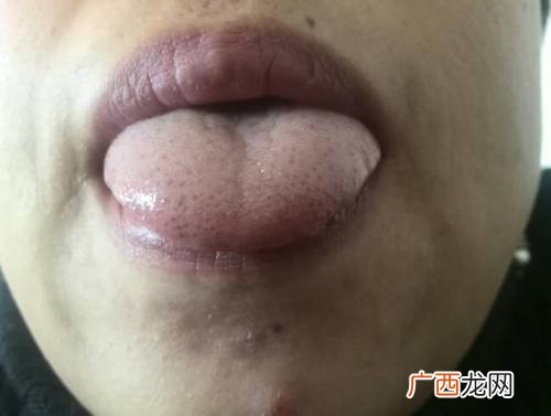 舌头上有许多小红点是什么原因,舌头上有小红点是怎么回事？