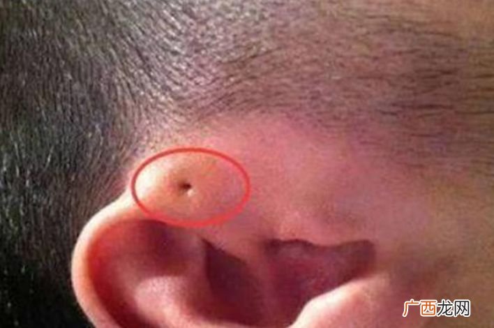 耳扩是怎么打的,打耳扩的人是什么心理？