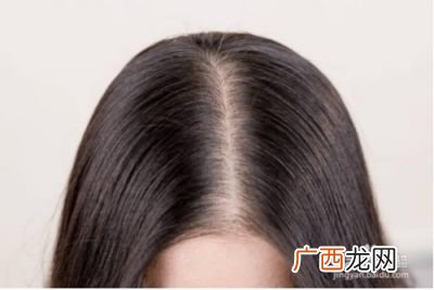 头皮疼怎么办,头皮痛是怎么回事？