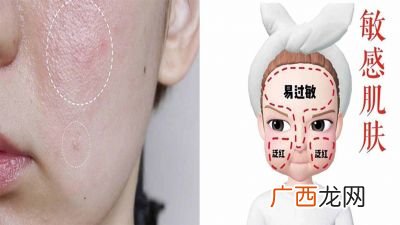 怎么判断肤质,如何判断自己的肤质？