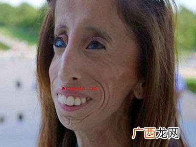 利兹 世界上最丑的女孩