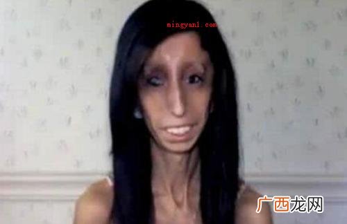 利兹 世界上最丑的女孩