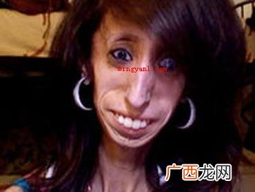 利兹 世界上最丑的女孩