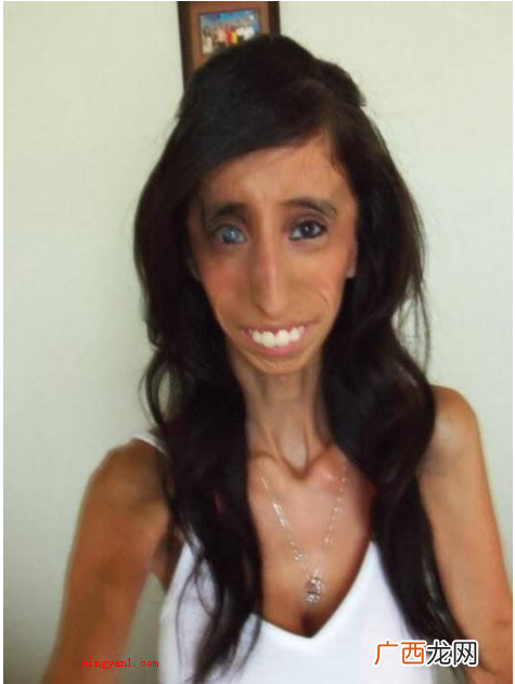 利兹 世界上最丑的女孩