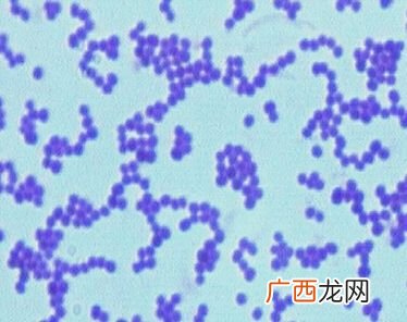 球菌是什么意思,球菌是什么？