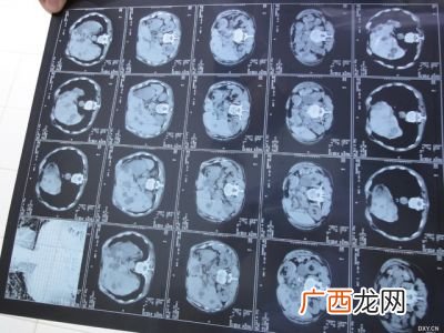 季肋区是哪里,胃的雅称？