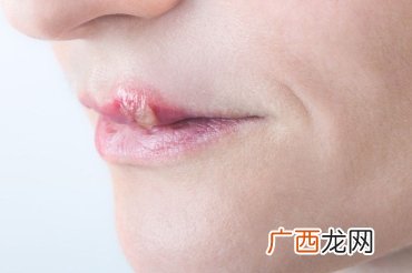 唇亡齿寒什么意思,唇亡齿寒的齿是什么意思？