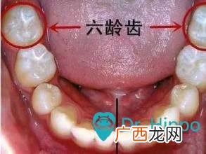 六龄牙是哪一颗,六龄齿位置？