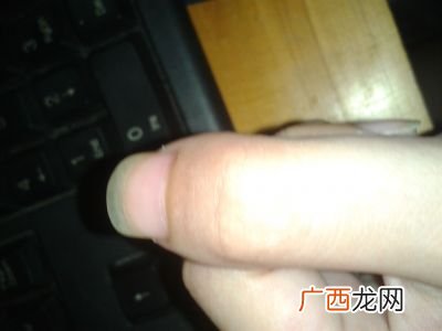 大拇指短粗代表什么,大母手指头粗的人他聪明吗？