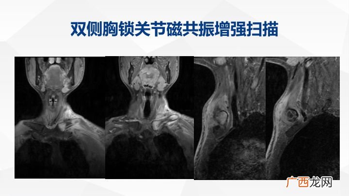 X线片是什么意思,x线和x片一样吗？