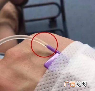 挂盐水的危害是什么,盐水发电的缺点和危害？