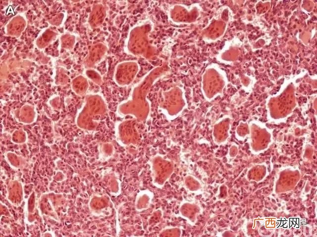 骨组织中的细胞分为哪四类,骨的构造和形态分布？