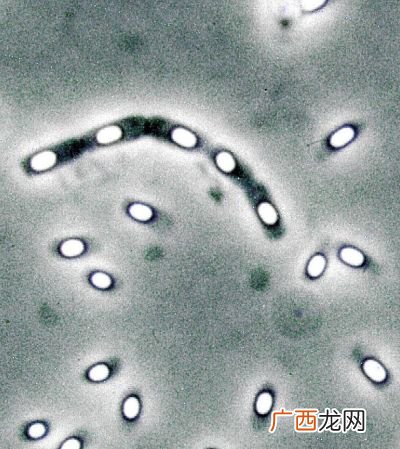 简称蜡芽 芽孢杆菌起什么作用,蜡质芽孢杆菌有哪些特点？主要防治哪些病害？
