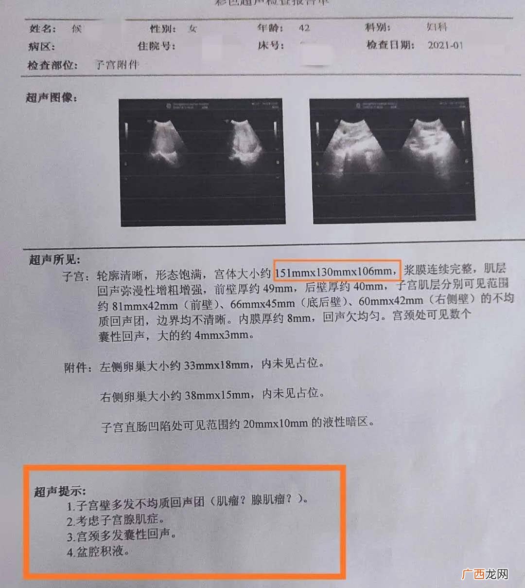 子宫大小正常范围是多少mm,子宫的大小大概范围是多少？