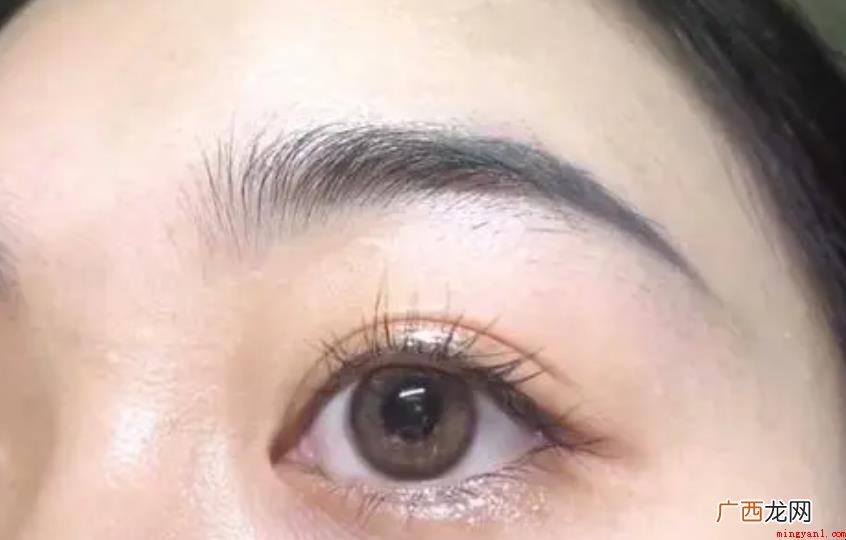 隐形眼镜滑片解决方案是什么 隐形眼镜滑片解决方法是什么